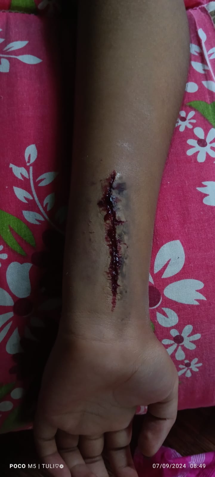 Before and After Bridal Transformation